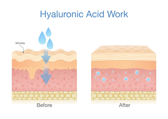 Cơ chế hoạt động của HYALURONIC ACID (HA) 