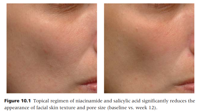 niacinamide cải thiện bề mặt da