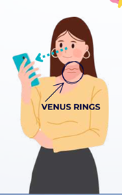 venus rings